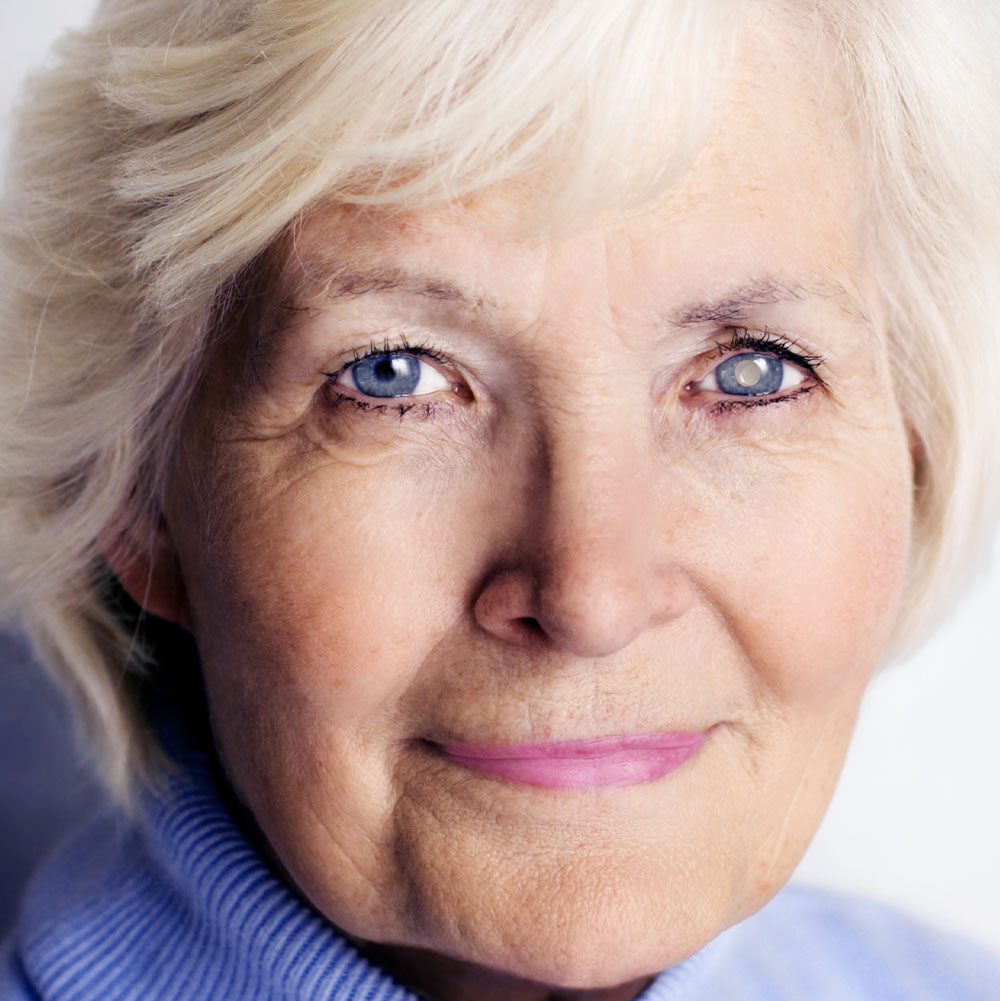 Cataract Surgery Co-Management in Melbourne